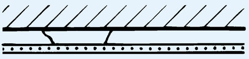隔音石膏板 - R 1.2101 - Saint Gobain Rigips